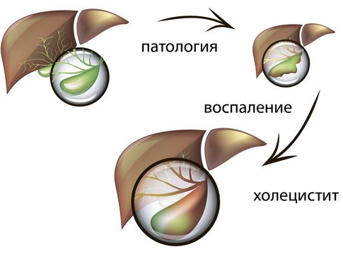 Болит правый, левый бок в районе талии со спины, сбоку, спереди у мужчин, женщин. Что делать