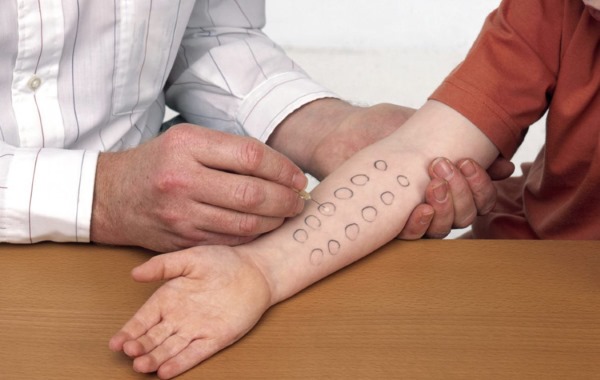 Иммуноглобулин Е человеческий: норма при беременности, у детей, взрослых. Причины повышенного уровня, лечение