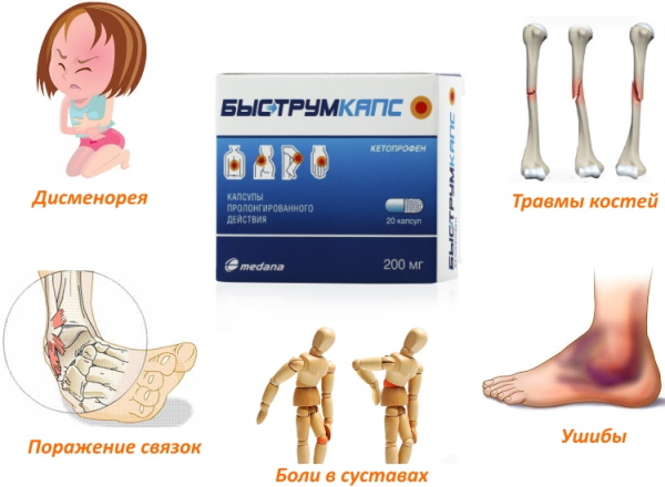 Кетопрофен таблетки и аналоги дешевле. Цена, отзывы