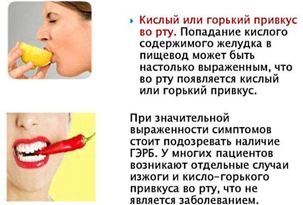 Кислый привкус во рту после еды, с изжогой и без, желтым и белым налетом на языке. Причины и лечение