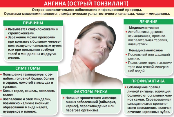 Ангина. Симптомы и лечение у взрослых, лекарства-антибиотики, народные средства