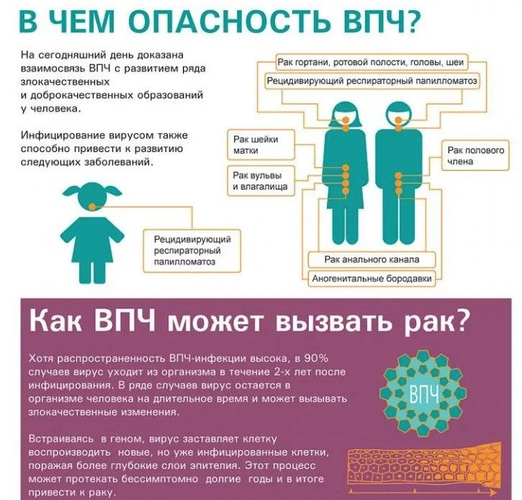 Лечение ВПЧ у женщин. Препараты, схема, клинические рекомендации врачей