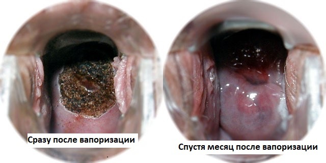 Заболевания шейки матки. Список, классификация, клинические рекомендации