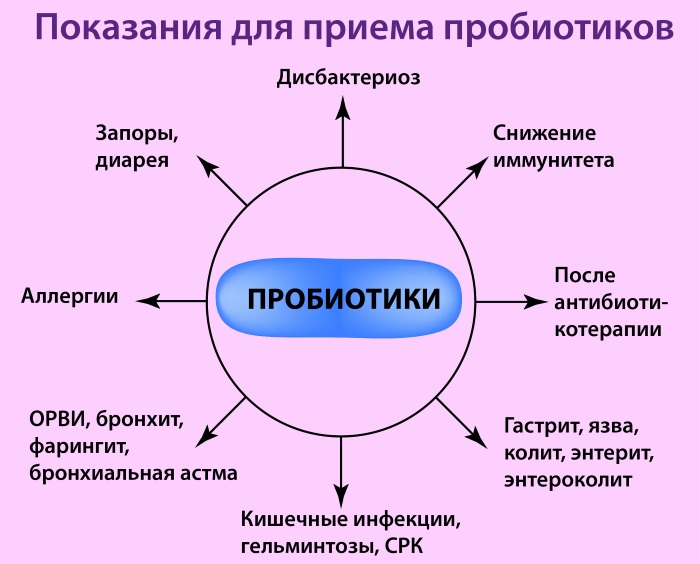 Колит правый бок на уровне пупка. Что это может быть