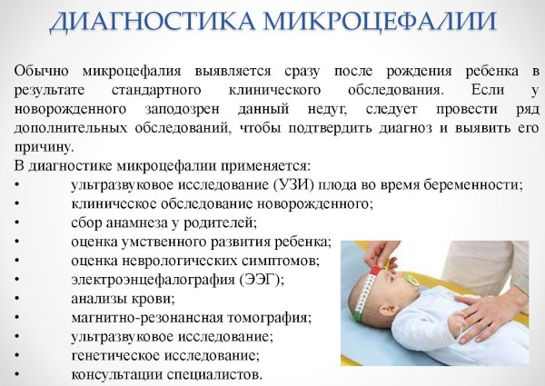 Микроцефалия. Что это за болезнь у детей