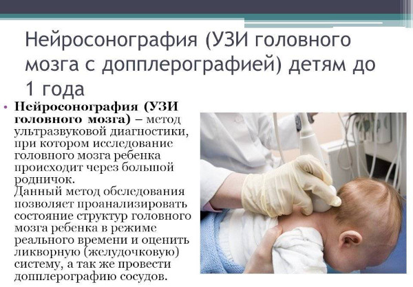 Микроцефалия. Что это за болезнь у детей