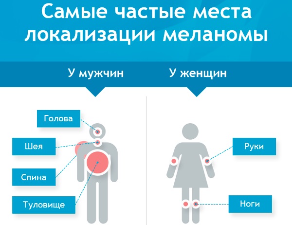 Наросты на коже. Фото и название. Что это и чем лечить