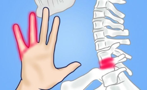 Немеют пальцы рук: причина и лечение: большой, мизинец, безымянный, указательный на левой и правой руке. С каким заболеванием связано