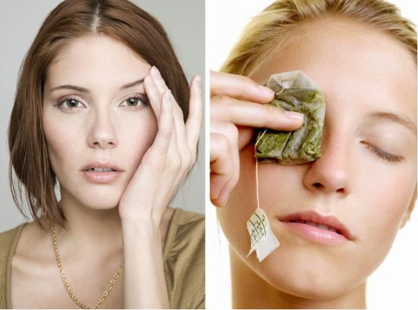 Опухшие глаза утром. Причины верхнее, нижнее веко, как убрать, избавиться от отеков