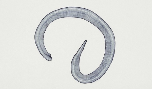 Острицы у детей. Симптомы и лечение, как выглядят, препараты, таблетки, народные средства