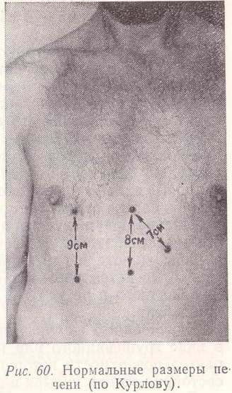 Пальпация печени по Курлову. Методика, алгоритм, этапы проведения, норма