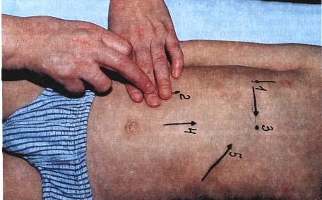 Пальпация печени по Курлову. Методика, алгоритм, этапы проведения, норма