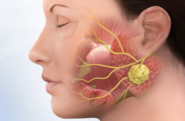 Паратонзиллярный абсцесс горла (паратонзиллит). Фото, лечение