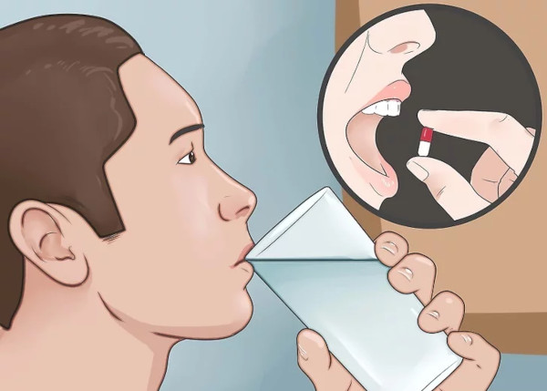 Паратонзиллярный абсцесс горла (паратонзиллит). Фото, лечение