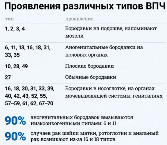 Перианальные кондиломы (остроконечные в перианальной области). Фото, лечение