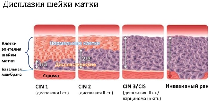 Заболевания шейки матки. Список, классификация, клинические рекомендации