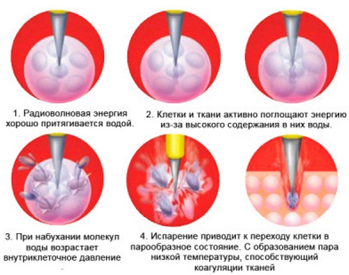 Заболевания шейки матки. Список, классификация, клинические рекомендации