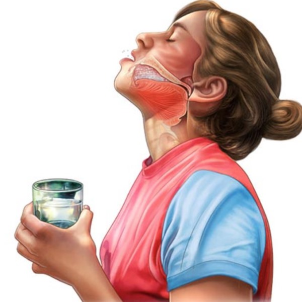 Пропал голос от простуды, болит горло. Как лечить лекарствами, народными средствами, таблетками, полосканием