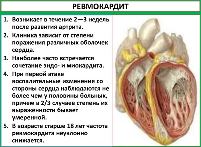 Сердечно-сосудистые заболевания. Список, что это такое, симптомы, статистика, какие бывают, причины, профилактика