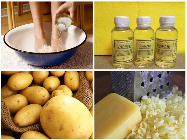 Шишка на пальце ноги. Лечение народными средствами артрита в домашних условиях: мази, кремы, рецепты народной медицины