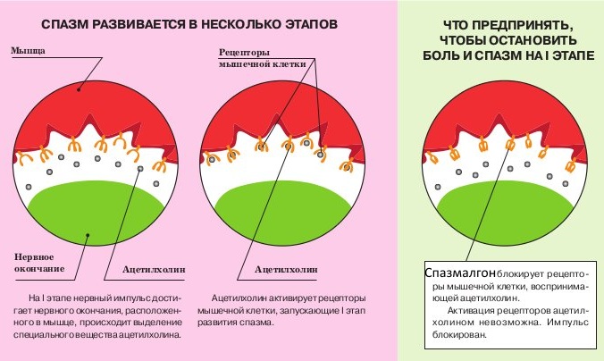 Спазмалгон (Spasmalgon) при головной боли. Инструкция по применению, состав, аналоги