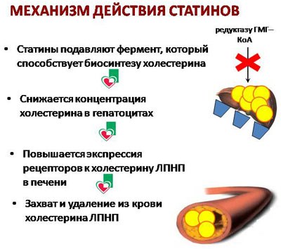 Статины – препараты последнего поколения для нормализации уровня холестерина. Названия, описание