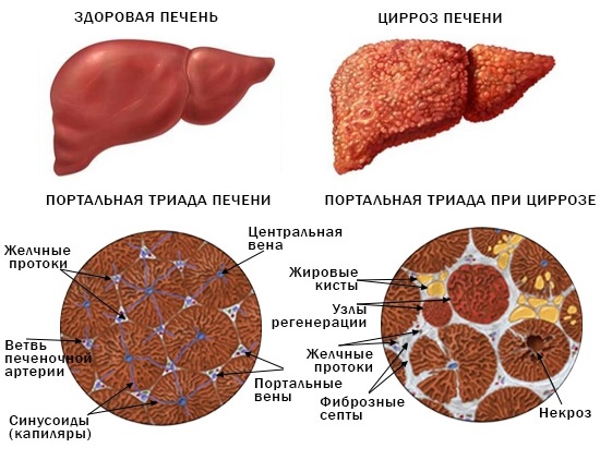 Антагонисты альдостерона. Препараты и механизм их действия