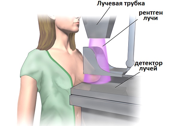 Болит грудь в середине цикла, второй половине, весь цикл. Почему набухла, что делать