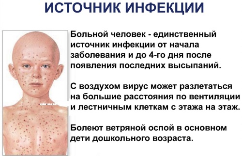 Ветрянка у детей: начало, симптомы, лечение в домашних условиях, инкубационный период, профилактика. Советы Комаровского