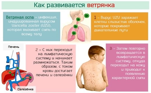 Ветрянка у детей: начало, симптомы, лечение в домашних условиях, инкубационный период, профилактика. Советы Комаровского