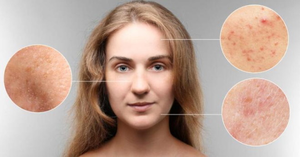 Вирусные заболевания кожи. Таблица, классификация, профилактика