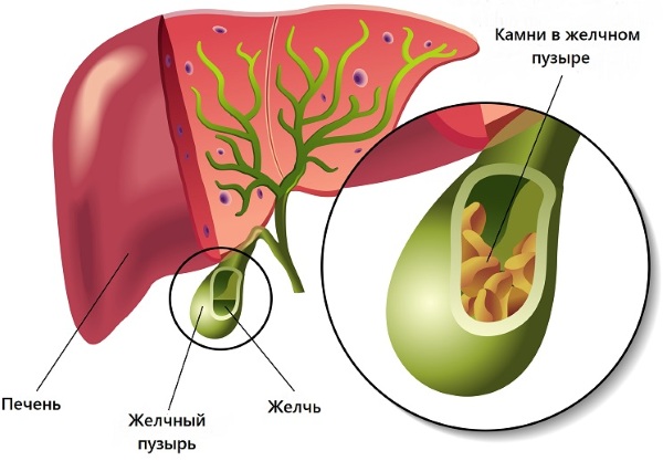 Спазмалгон (Spasmalgon) при головной боли. Инструкция по применению, состав, аналоги