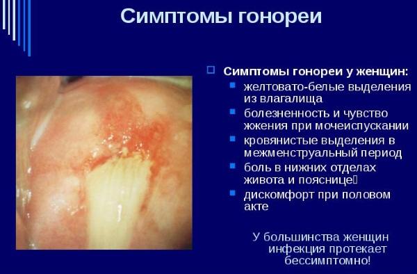 Жжение при мочеиспускании у женщин. Причины боли, резь, кровь, дискомфорт, частые позывы ночью. Лечение